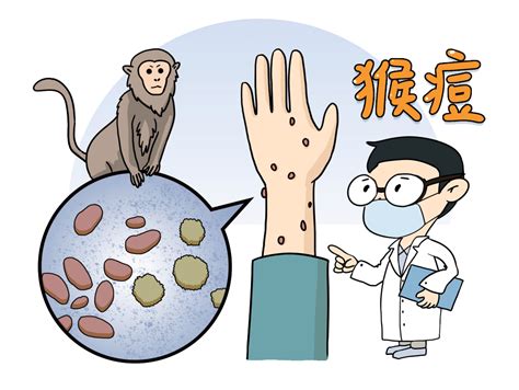 一颗猴痘能感染多少人