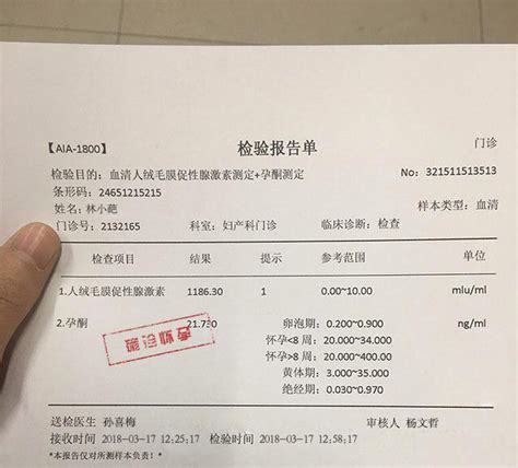 上海尿检费用多少