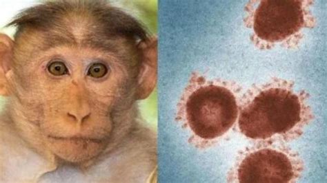 专家称猴痘疫情不寻常