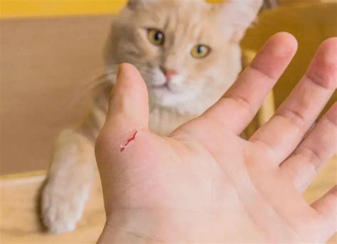 做梦手指被猫咬了是什么意思