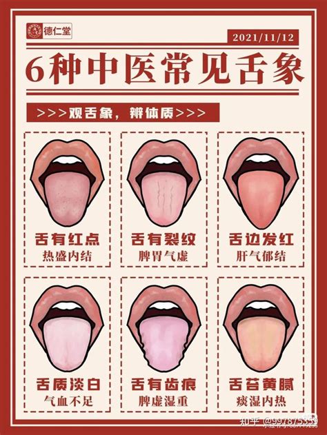 分舌有几种方法