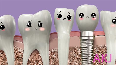 哪种牙齿不适合种植牙齿