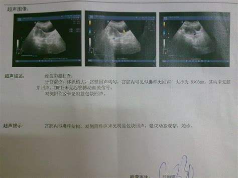 在青岛医院拍腹部b超多少钱