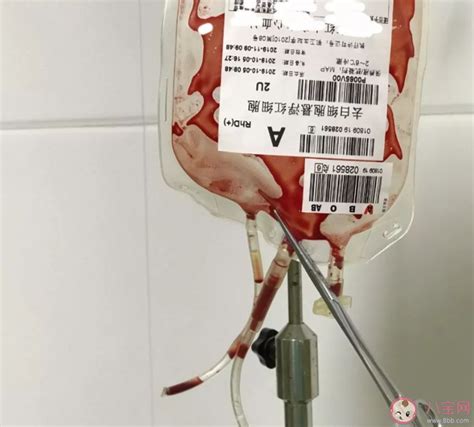 女子输血后染艾滋病潜伏期10年