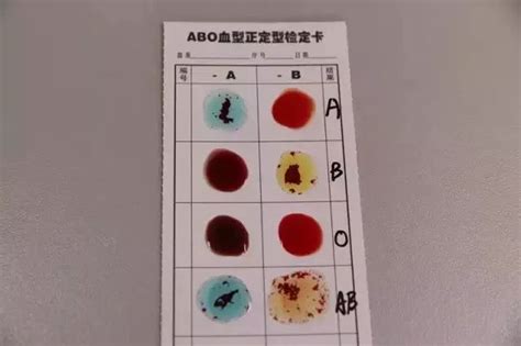 如何判断血型
