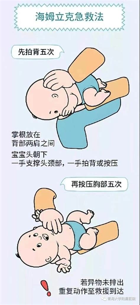 婴幼儿海姆立克法急救的操作步骤