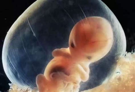 孕囊就是胚胎对吗