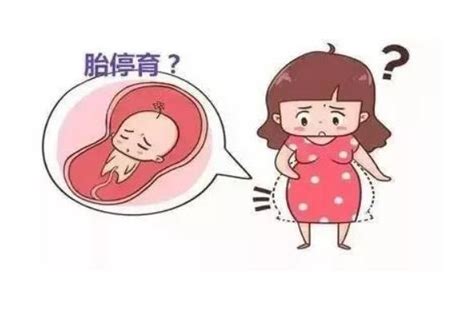 孕妇多少周之内容易胎停