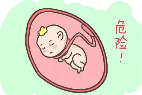 孕30周胎死腹中的方法