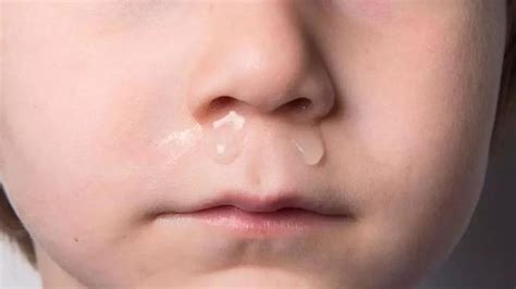 宝宝反复流鼻涕是什么原因