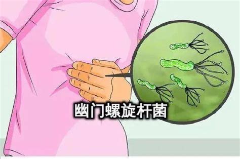 幽门螺杆菌筛查 北京