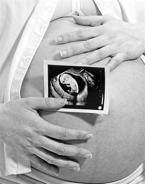 怀孕多少周胎儿容易发生畸形