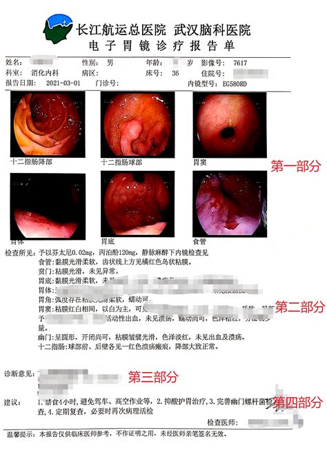 急性肠胃炎报告单图片