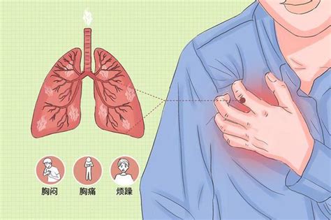 急性胸痛时的急救方法