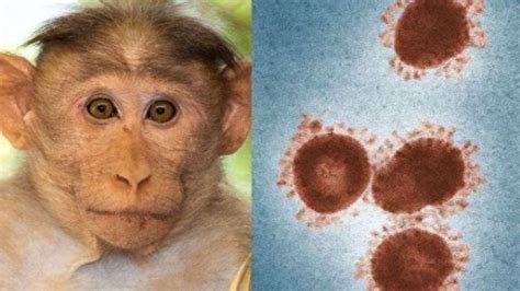 我国首次报告5例女性猴痘病例是什么