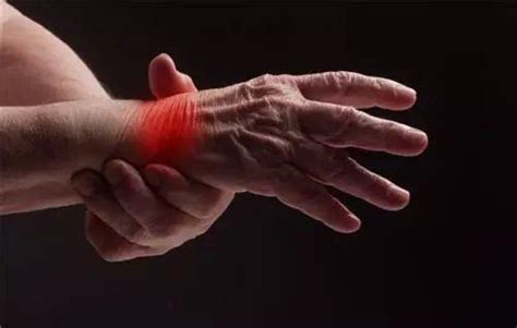 手局部肌肉损伤怎么缓解