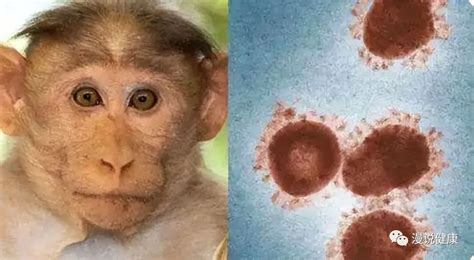 猴痘是什么病毒中国有吗
