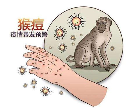 猴痘的传染性有多强