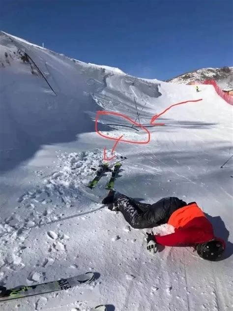 男子在雪山上滑雪不幸摔断腿