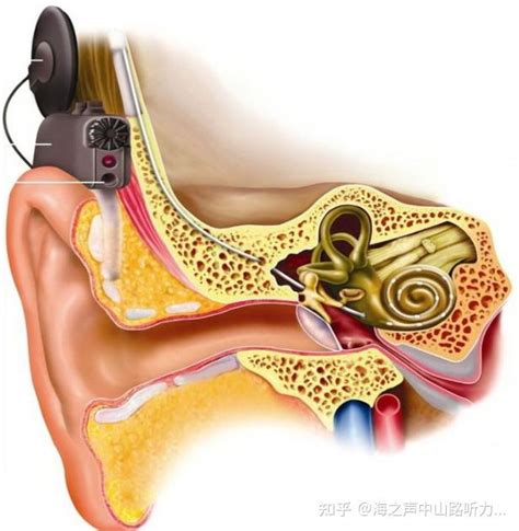 耳蜗位移传感器