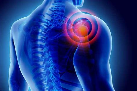 肩膀痛怎么办最快最有效的办法