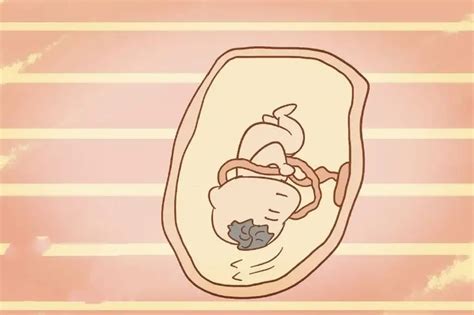 胎儿早期脐带绕颈一周怎么办