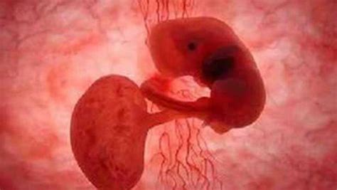 胚胎三周算一个生命吗