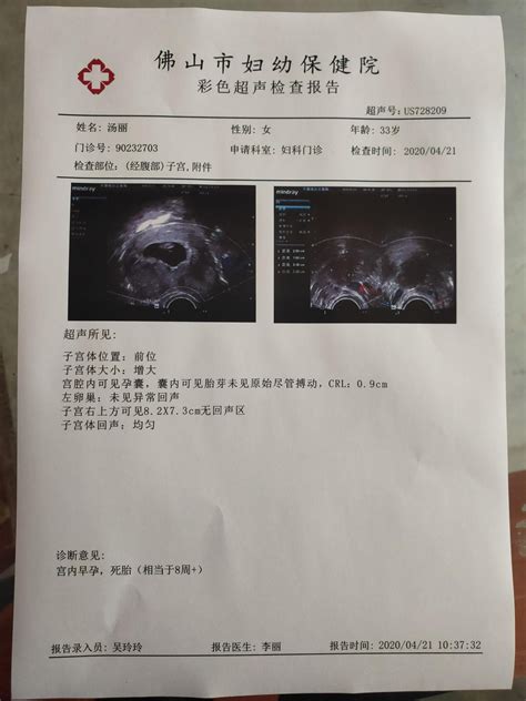 重庆妇幼保健院的b超设备如何