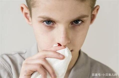 10岁左右经常流鼻血怎么回事