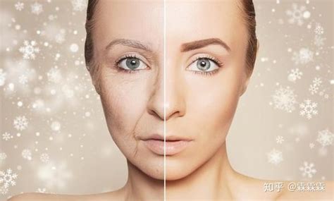 40岁女人脸型衰老症状