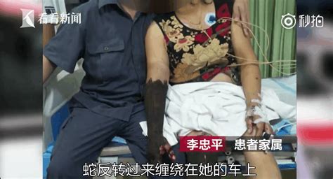 55岁女子被毒蛇咬伤