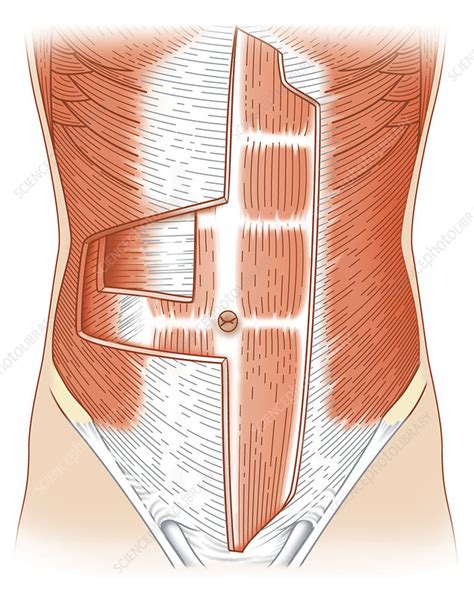 abdominalmuscles中文