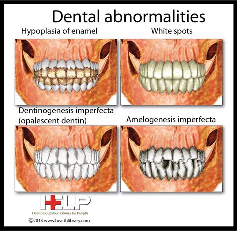 abnormal development of teeth