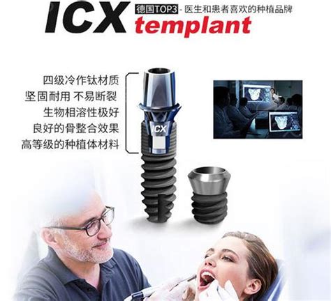 icx种植牙 多少钱
