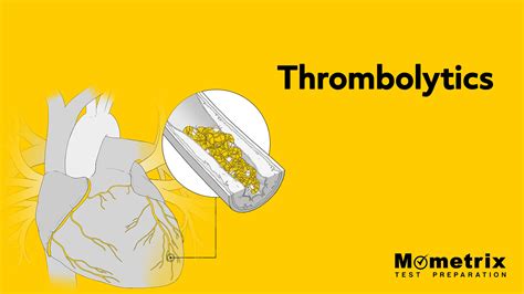 thrombolytic therapy